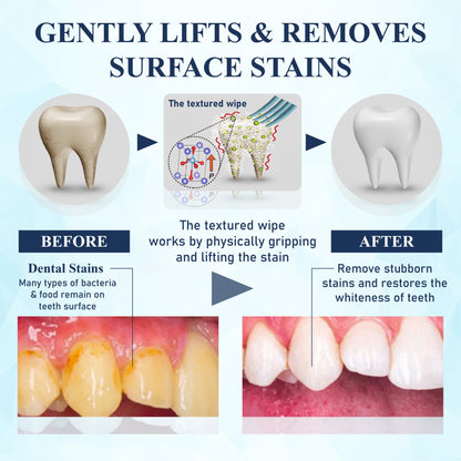 HandyFidgetGround™ BrighteWipe Teeth Cleaning Finger Wipes