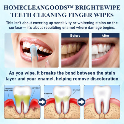 HandyFidgetGround™ BrighteWipe Teeth Cleaning Finger Wipes