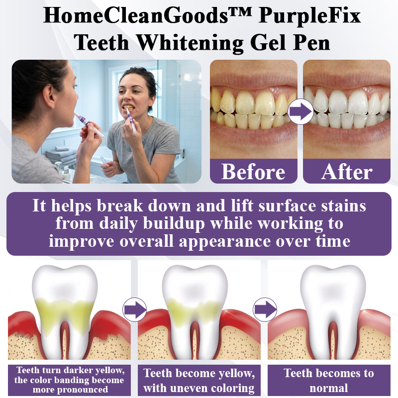 HandyFidgetGround™ PurpleFix Teeth Whitening Gel Pen