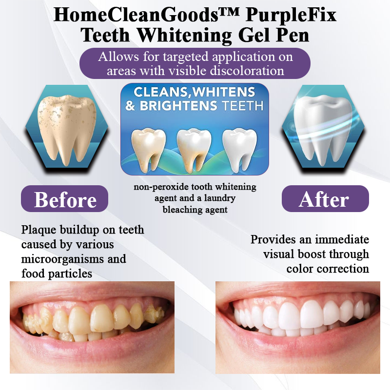 HandyFidgetGround™ PurpleFix Teeth Whitening Gel Pen