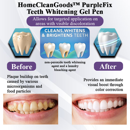 HandyFidgetGround™ PurpleFix Teeth Whitening Gel Pen