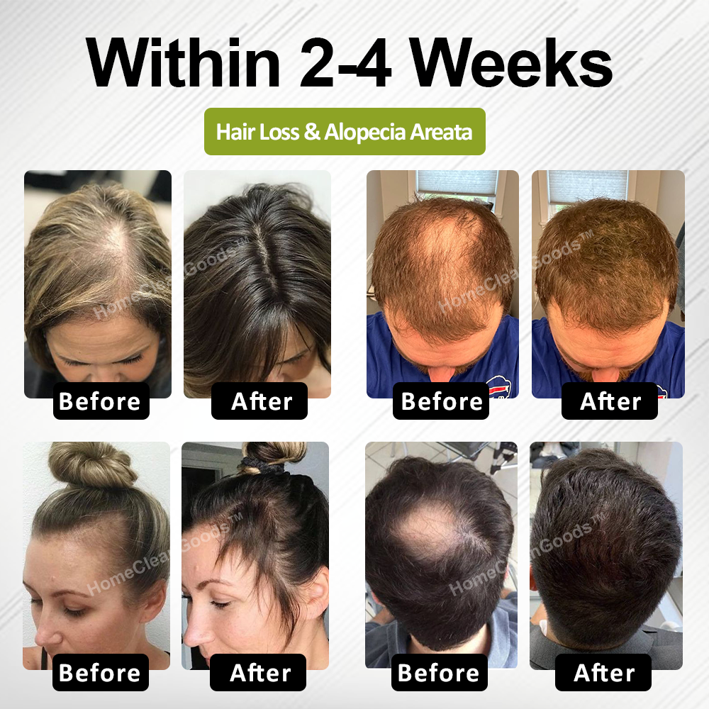 HiFiveGo™ RootBloom Hair Revival Serum
