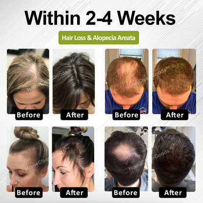 HiFiveGo™ RootBloom Hair Revival Serum