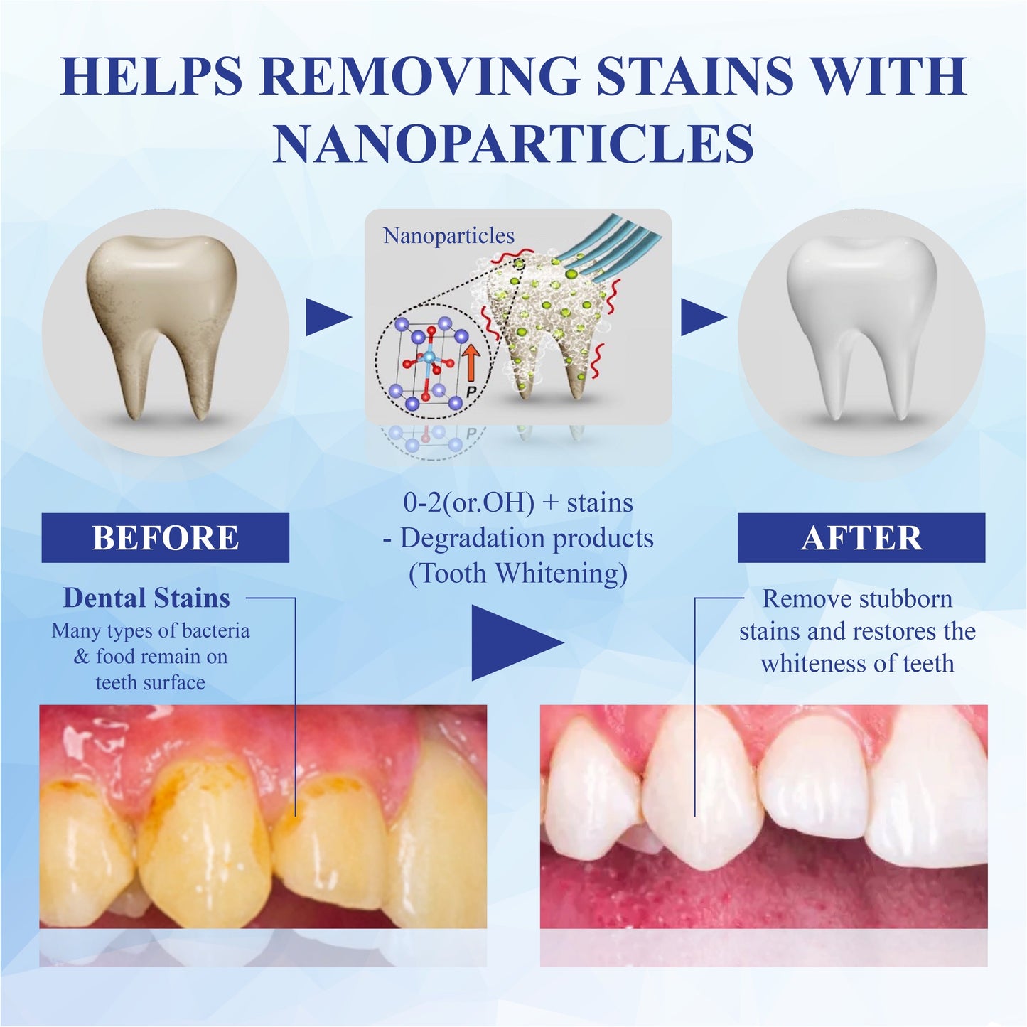 HandyFidgetGround™ SmilePolish Nano Teeth Stain Cleaner