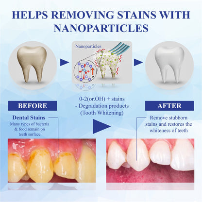 HandyFidgetGround™ SmilePolish Nano Teeth Stain Cleaner