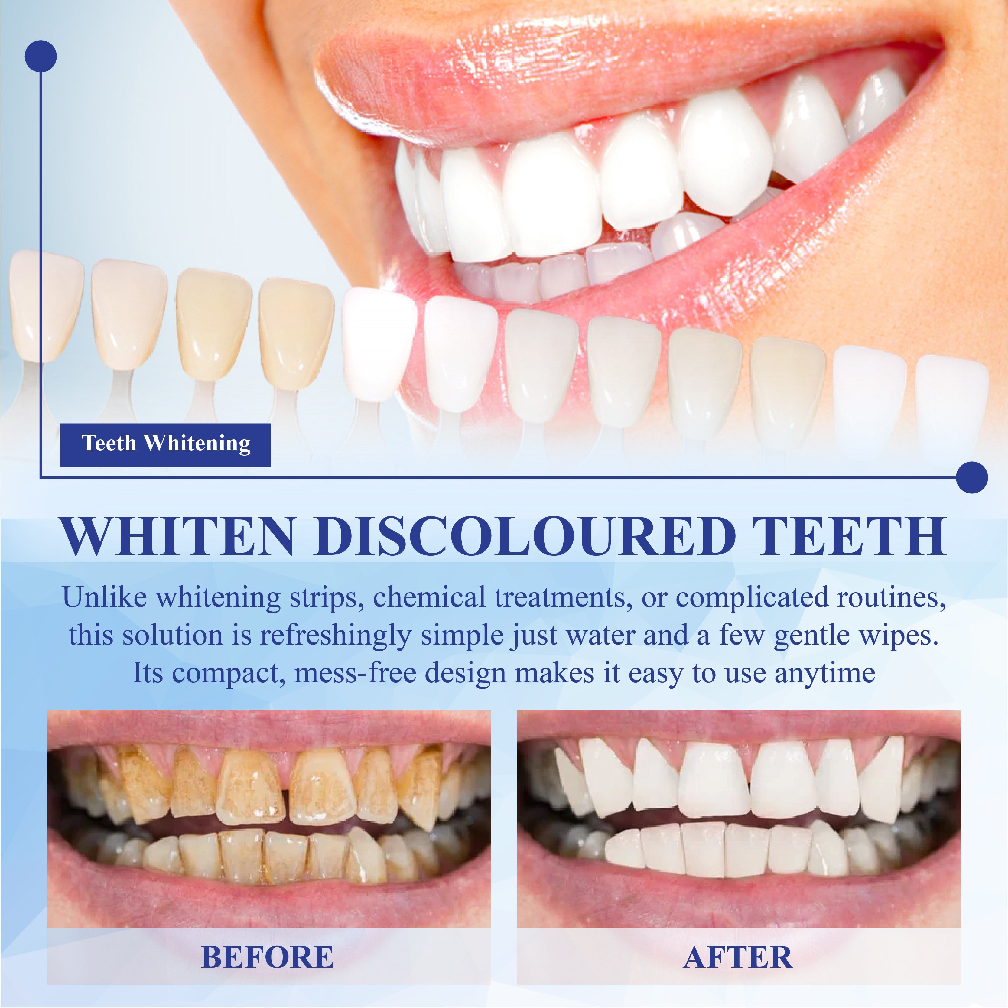 HandyFidgetGround™ SmilePolish Nano Teeth Stain Cleaner