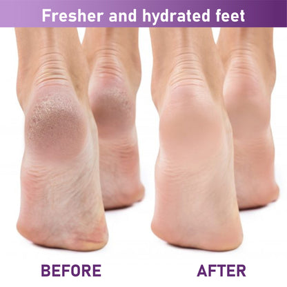 HandyFidgetGround™ SmoothStep Exfoliating Foot Peel Mask Sock